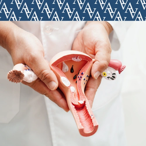 foto representando a Ginecologia Estética