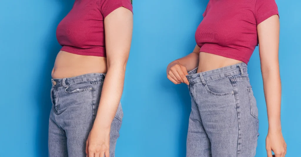 antes e depois de tratamento para a flacidez na barriga