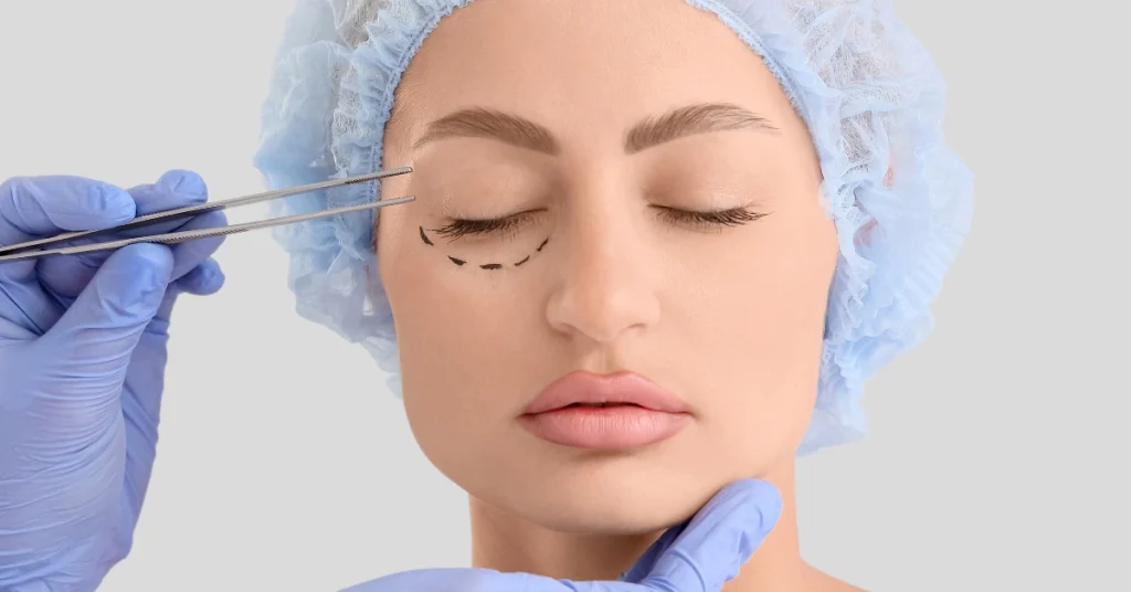 Cirurgia das pálpebras que rejuvenesce o olhar, remove excesso de pele e bolsas. Resultados naturais com recuperação rápida. Saiba tudo na Antoniassi Clinic.